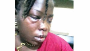 Ogun Trader Hospitalized After Neighbor's Brutal Assault, Suspect Flees